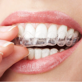 Invisalign Tray with Blue Wolf Dental