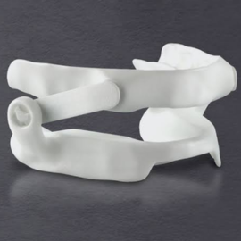 Custom oral appliance for sleep apnea treatment